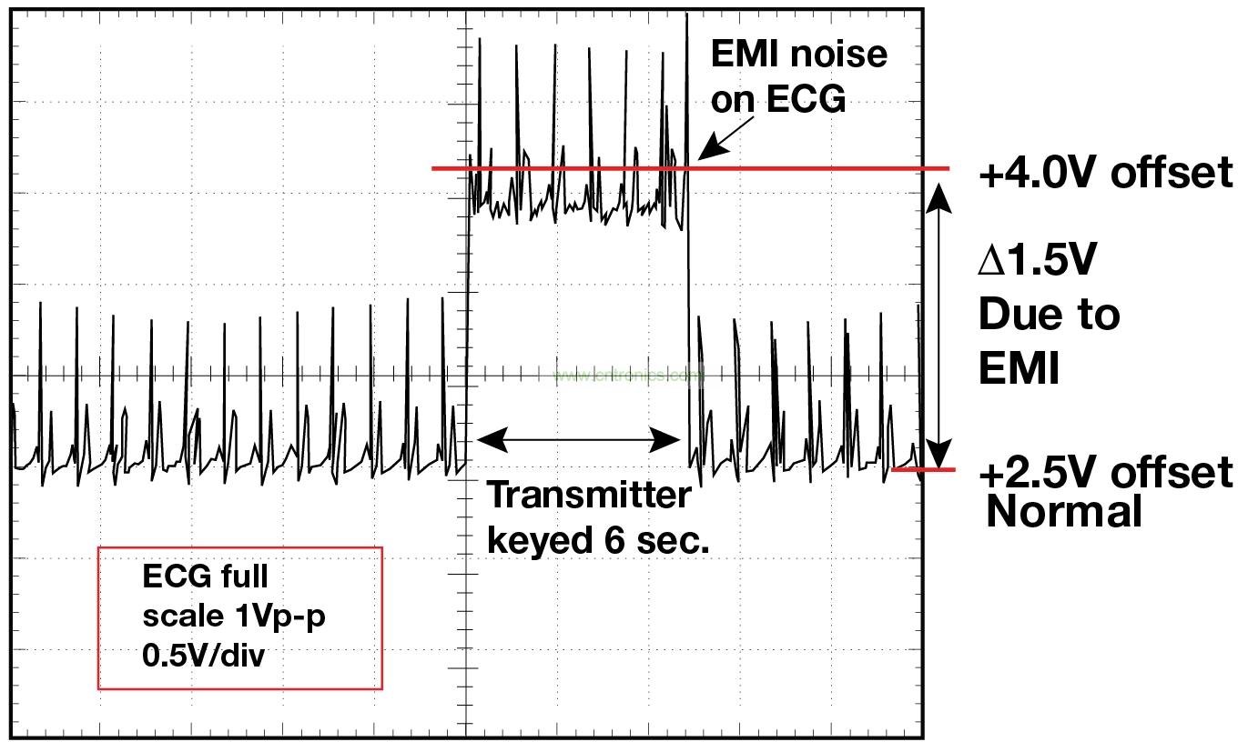 圖 1    1.5 英尺以外的發(fā)射器（f = 470 MHz, P= 0.5W）開啟和關(guān)閉時(shí) ECG 診斷設(shè)備的心臟檢查結(jié)果